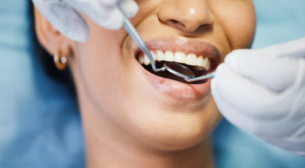 Best Emergency Dental Care for Broken or Chipped Teeth in Oneida, TN